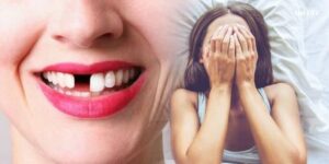 Sự thật: Nằm mơ thấy rụng răng là điềm gì?