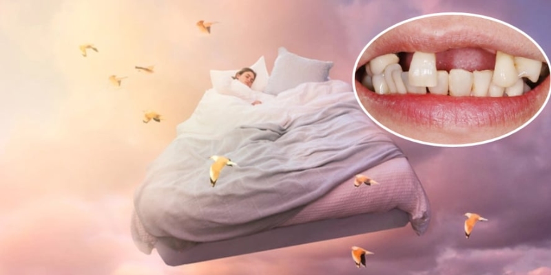 Nằm mơ thấy rụng răng hàm trên