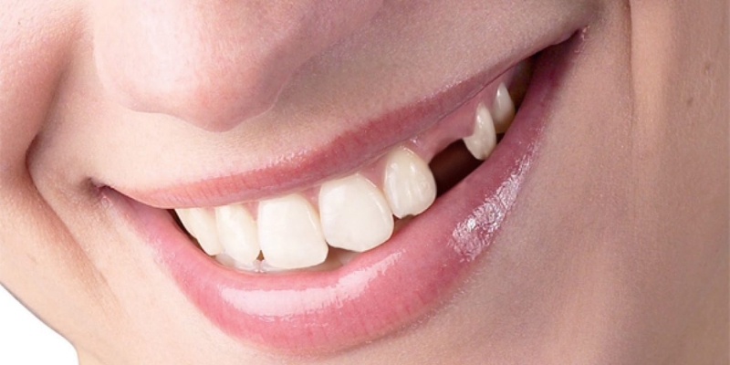 Giấc mơ rụng răng mang nhiều tầng ý nghĩa sâu sắc